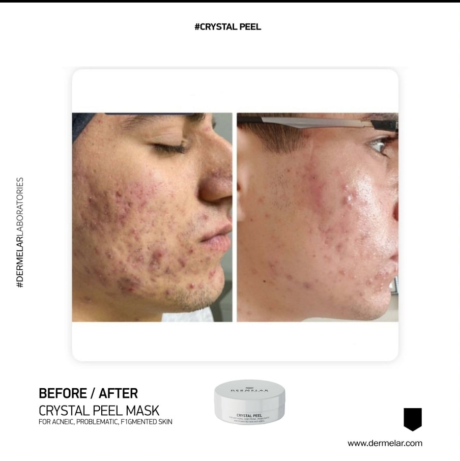 MASQUE CRYSTAL PEEL 100ML 20 Soins