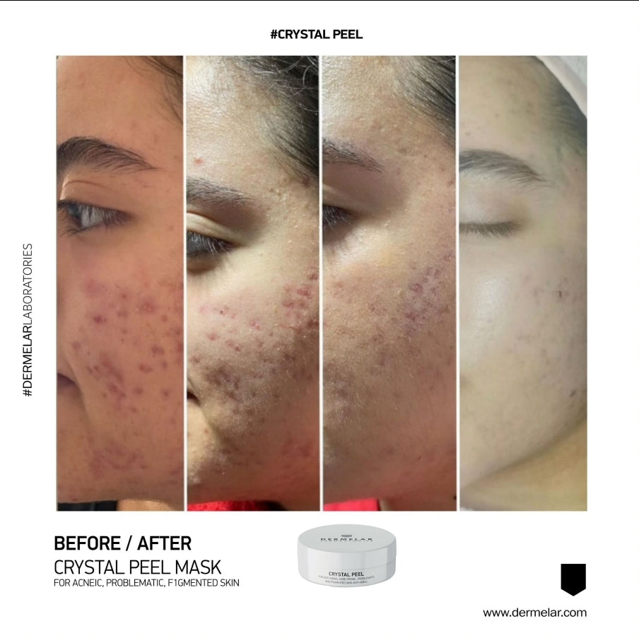 MASQUE CRYSTAL PEEL 100ML 20 Soins
