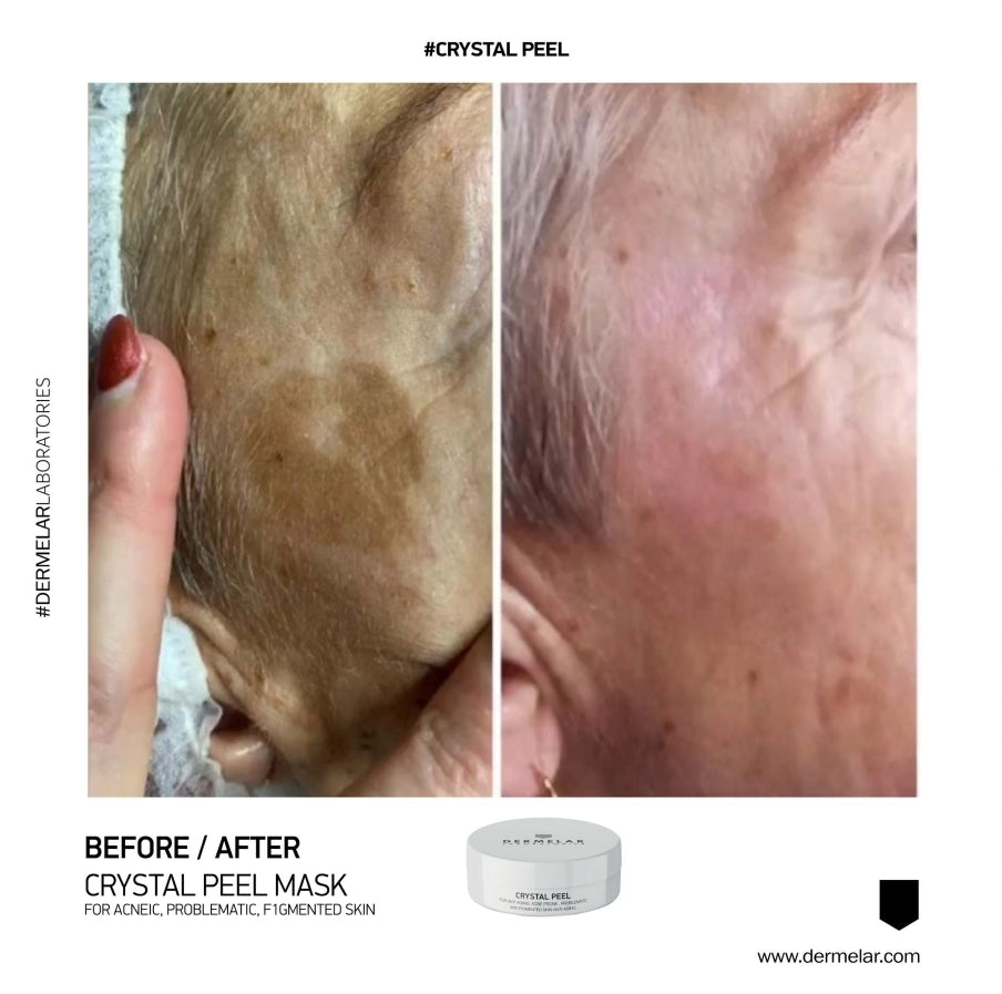 MASQUE CRYSTAL PEEL 100ML 20 Soins