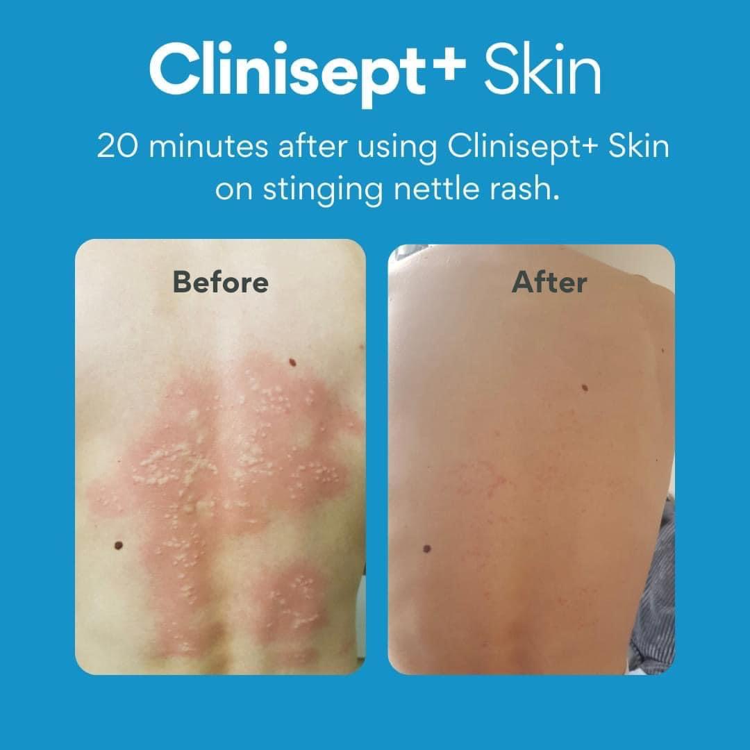 11+1 Free CLINISEPT+ SKIN 100ml